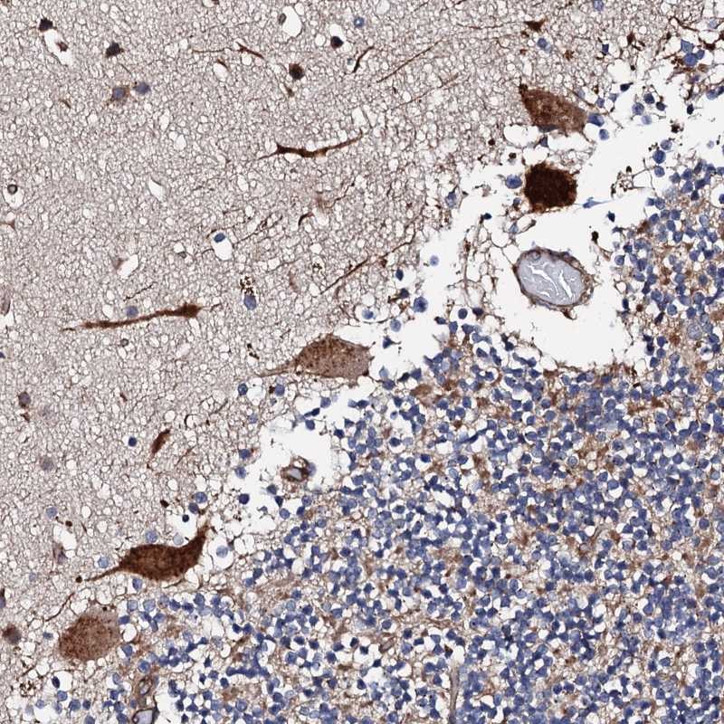 Anti-RCBTB2 Antibody