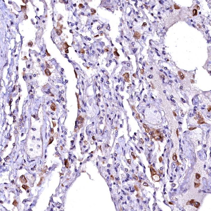 Anti-OVCH1 Antibody