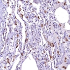 Anti-OVCH1 Antibody