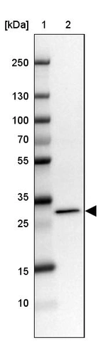 Lane 1: Marker [kDa] 250, 130, 100, 70, 55, 35, 25, 15, 10_br/_Lane 2: Human cell line MOLT-4