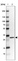 Anti-RCBTB2 Antibody