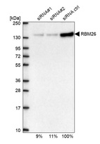 Western blot analysis in U2OS cells transfected with control siRNA, target specific siRNA probe #1 and #2, using Anti-RBM26 antibody. Remaining relative intensity is presented.