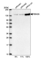 Anti-RBM26 Antibody