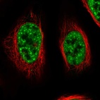 Immunofluorescent staining of human cell line U-2 OS shows localization to nuclear speckles.
