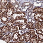 Immunohistochemical staining of human kidney shows strong granular cytoplasmic positivity in cells in tubules.