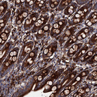 Immunohistochemical staining of human duodenum shows strong granular cytoplasmic positivity in glandular cells.
