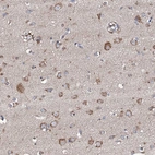 Immunohistochemical staining of human cerebral cortex shows moderate granular cytoplasmic positivity in neurons.