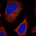 Immunofluorescent staining of human cell line U-2 OS shows localization to vesicles.
