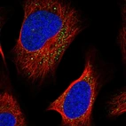 Immunofluorescent staining of human cell line U-2 OS shows localization to vesicles.