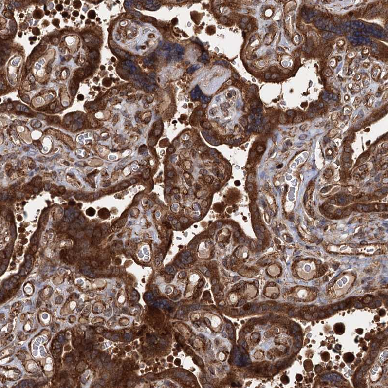 Anti-ATP8B4 Antibody