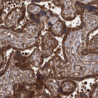 Anti-ATP8B4 Antibody