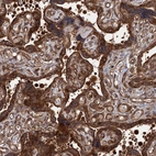 Anti-ATP8B4 Antibody