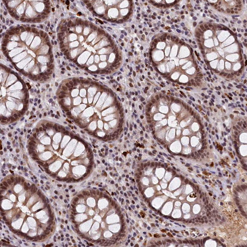 Anti-INTS14 Antibody