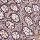 Anti-INTS14 Antibody