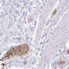 Anti-EPB42 Antibody
