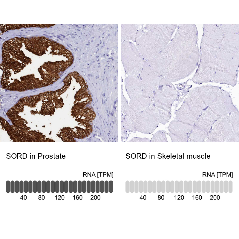 Anti-SORD Antibody
