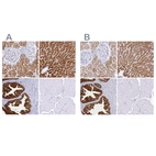 Immunohistochemical staining of human kidney, liver, prostate and skeletal muscle using Anti-SORD antibody HPA040260 (A) shows similar protein distribution across tissues to independent antibody HPA040621 (B).