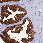Immunohistochemical staining of human prostate shows strong cytoplasmic positivity in glandular cells.