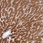 Immunohistochemical staining of human liver shows strong cytoplasmic positivity in hepatocytes.