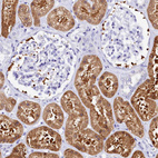 Immunohistochemical staining of human kidney shows strong cytoplasmic positivity in cells in tubules.