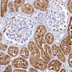 Immunohistochemical staining of human kidney shows strong cytoplasmic positivity in cells in tubules.