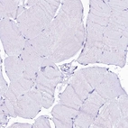 Immunohistochemical staining of human skeletal muscle shows no positivity in myocytes as expected.