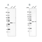 Western blot analysis using Anti-SORD antibody HPA040260 (A) shows similar pattern to independent antibody HPA040621 (B).