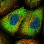Immunofluorescent staining of human cell line A-431 shows localization to cytosol.