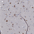 Anti-TMX2 Antibody