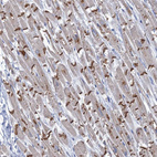 Immunohistochemical staining of human Heart muscle shows strong cytoplasmic positivity in cardiomyocytes.