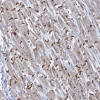 Immunohistochemical staining of human Heart muscle shows strong cytoplasmic positivity in cardiomyocytes.
