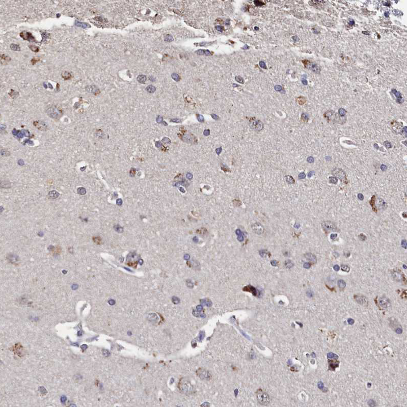 Anti-C11orf49 Antibody