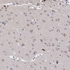 Anti-C11orf49 Antibody