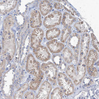 Immunohistochemical staining of human Kidney shows moderate granular cytoplasmic positivity in cells in tubules.