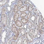 Immunohistochemical staining of human Kidney shows moderate granular cytoplasmic positivity in cells in tubules.