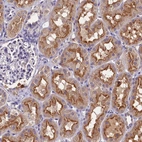 Immunohistochemical staining of human kidney shows strong cytoplasmic positivity in cells in tubules.