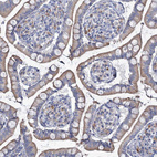 Immunohistochemical staining of human Small intestine shows moderate granular cytoplasmic positivity in glandular cells.