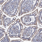 Immunohistochemical staining of human Small intestine shows moderate granular cytoplasmic positivity in glandular cells.