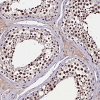 Immunohistochemical staining of human testis shows strong nuclear positivity in cells in seminiferous ducts.