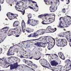 Immunohistochemical staining of human placenta shows no positivity in trophoblastic cells as expected.