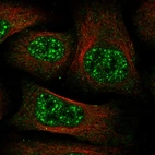 Immunofluorescent staining of human cell line U-2 OS shows localization to nuclear speckles.