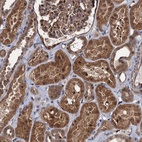 Anti-ZFYVE19 Antibody