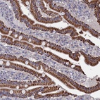 Anti-ZNF891 Antibody