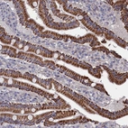 Anti-ZNF891 Antibody
