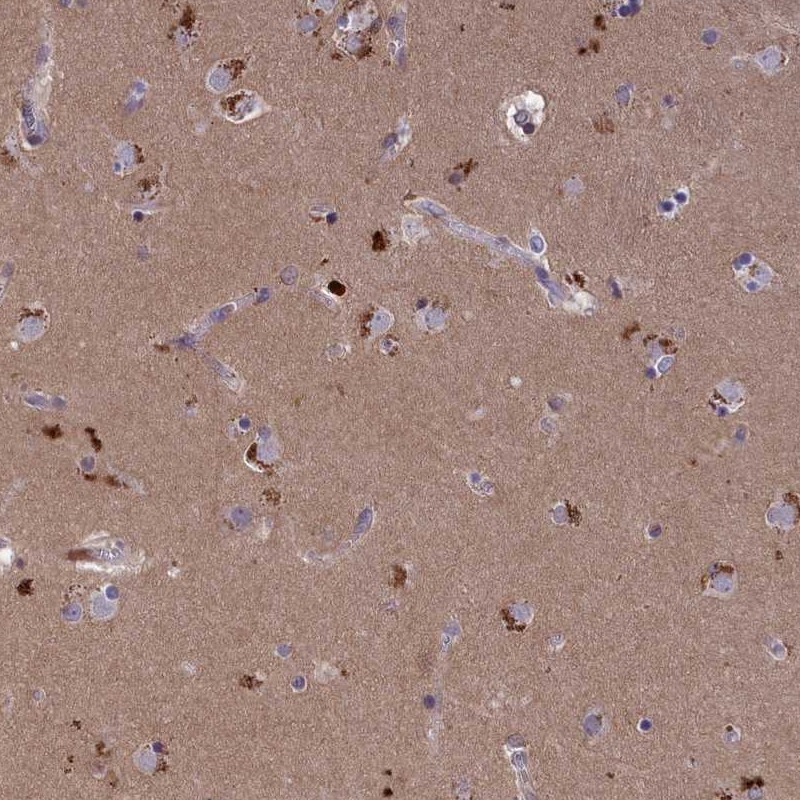 Anti-STYX Antibody