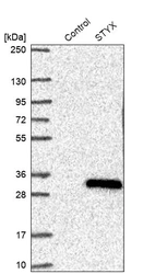 Western blot analysis in control (vector only transfected HEK293T lysate) and STYX over-expression lysate (Co-expressed with a C-terminal myc-DDK tag (~3.1 kDa) in mammalian HEK293T cells, LY407985).