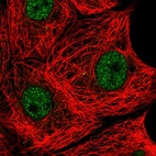 Immunofluorescent staining of human cell line MCF7 shows localization to nucleoplasm.