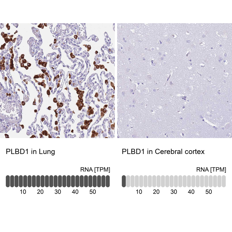 Anti-PLBD1 Antibody