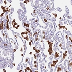 Immunohistochemical staining of human lung shows strong cytoplasmic positivity in macrophages.