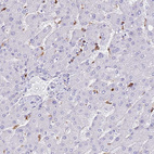 Immunohistochemical staining of human liver shows moderate positivity in Kupffer cells.
